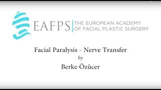 Facial Paralysis Nerve Transfer [upl. by Bolte]