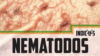 Nematodos Gastrointestinales Sub English [upl. by Jacky496]