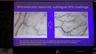 What’s new IN Microcirculation 2019 Can Ince [upl. by Kelcie116]