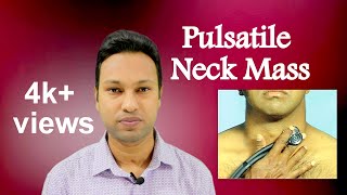 Pulsatile Neck Mass Aetiologies and Diagnosis [upl. by Wardlaw317]