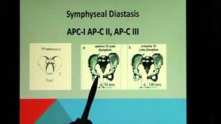 Symphyseal Diastasis and Symphysis Pubis Dysfunction Part 2 Jerry Hesch [upl. by Vallery664]