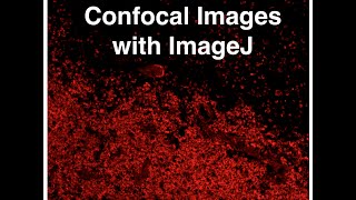 Analyzing Confocal Images with ImageJ [upl. by Lathrop]