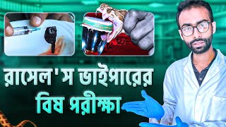 রাসেলস ভাইপারের বিষ মানুষের শরীরে কি ঘটায় সাপে কাটলে যেসব ভুল করা যাবে না Sabbir Ahmed [upl. by Chan]