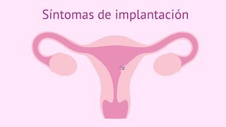 Síntomas de implantación del embrión [upl. by Joelynn843]