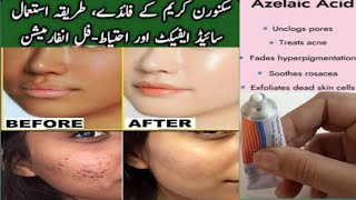 skinoren cream use and side effects  How to use azelaic acid [upl. by Bremer]