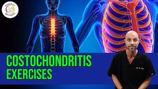 Costochondritis Exercises [upl. by Viafore661]