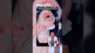 Teratoma Que es   MEDICINA CLINICA SHORTS [upl. by Norita]