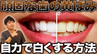 【歯を白くする方法】自力で歯の黄ばみを落とす方法を医師が解説！ [upl. by Rakel883]