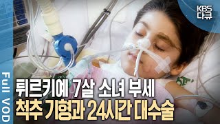 선천적 척추 기형 12시간 장거리 비행 24시간 대수술 마지막 희망을 안고 한국에 온 7살 튀르키예 소녀 부세  현장기록 병원  KBS 20070121 방송 [upl. by Tekla947]