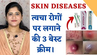 Top 3 Ointments for all Skin Diseases ॥ त्वचा रोगों पर लगाने के बेस्ट 3 क्रीम ॥ [upl. by Scott]