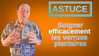 ASTUCE  Extraire EFFICACEMENT une verrue plantaire [upl. by Trab]