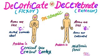 Decorticate Vs Decerebrate RigidityMnemonic for USMLE [upl. by Eleni]