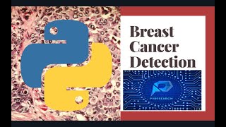 Breast Cancer Prediction Using Machine Learning  Python [upl. by Sherill405]