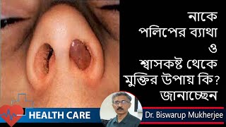 Nasal Polyps Treatment  নাকে পলিপের ব্যাথা ও শ্বাসকষ্ট থেকে মুক্তির উপায় Dr Biswarup Mukherjee [upl. by Noryv]