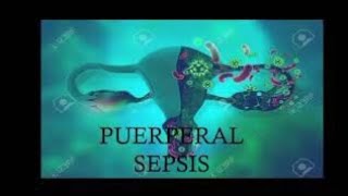 Puerperal SepsisMidwifery and Obstetrical NursingBsc Nursing [upl. by Senaj245]