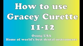 How to use Gracey Curette 1112 [upl. by Anyad]