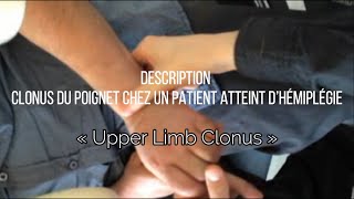 Clonus du poignet chez les patients un atteint d’hémiplégie « Upper Limb Clonus » [upl. by Aicenaj]