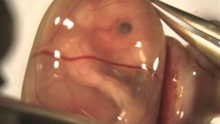 Isolation and injection of an E155 mouse embryo [upl. by Glynas281]