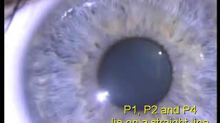 Purkinje images in normal eye [upl. by Chrotoem]