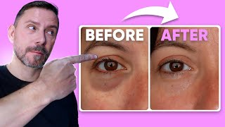 HOW TO MAKE EYE BAGS VANISH IN SECONDS FULL DEMO [upl. by Adnert]