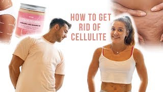 CELLULITE REMOVAL What They Dont Tell YOU [upl. by Jean-Claude]