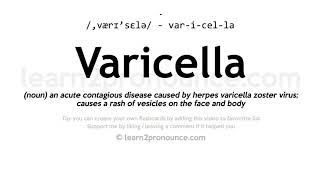 Varicella pronunciation and definition [upl. by Asare]