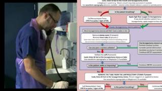 Laryngectomy Detailed Initial Assessment [upl. by Oremor]