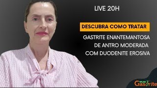 Descubra como tratar gastrite enantemantosa de antro moderada com duodenite erosiva [upl. by Georgine]