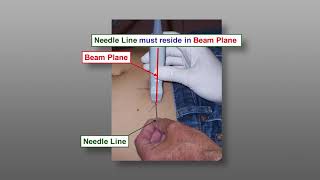 Fine Needle Aspiration Biopsy FNA Techniques  Ultrasound Guided FNA The Parallel Approach [upl. by Aem]