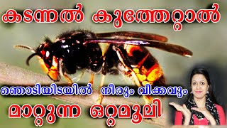 കടന്നൽ കുത്തേറ്റാൽ ഞൊടിയിടയിൽ നീരും വീക്കവും മാറ്റുന്ന ഒറ്റമൂലി INSECT BYTE NATURAL REMEDY [upl. by Eilarol]