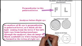 Polarization Method  Polarized Targets and Polarizing Filters Binocular Subjective Refraction 34 [upl. by Enilkcaj]