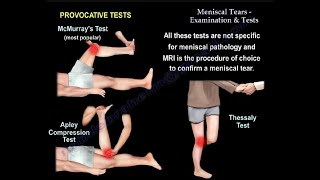 Meniscal Tears Examination amp Tests [upl. by Oakley]