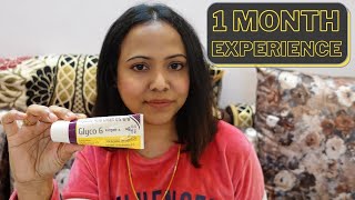 Glyco 6 cream  Glycolic 6 Cream Review In Hindi  Honest Review [upl. by Hebrew]