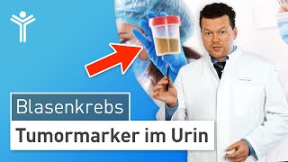 UrinSchnelltest Blasenkrebs durch Tumormarker erkennen [upl. by Iramaj]