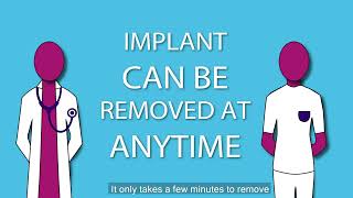 NHS Contraceptive Implant Information Video [upl. by Atinel]