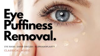 𝄞 Powerful Blepharoplasty  Remove Eye Puffiness  Eye Bags  Dark Circles  Classical Music [upl. by Gall827]