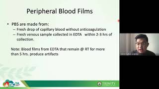 Chemical Reactions 4 of 11 Decomposition Reactions An Explanation [upl. by Sivi961]