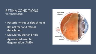 Demystifying Retinal Diseases [upl. by Nightingale]