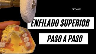 COMO enfilar Dientes en Protesis Parcial [upl. by Franky]