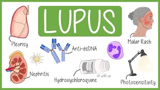 Systemic Lupus Erythematosus in 3 Minutes [upl. by Hanleigh]