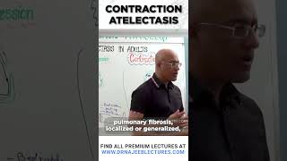 Contraction Atelectasis drnajeeb drnajeeblectures shortvideostatus [upl. by Lucrece933]