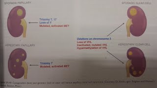 Renal Cell Carcinoma  SPECIAL PATHOLOGY [upl. by Lleder]