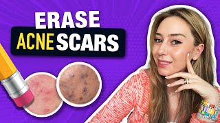 How to Treat amp Fade Acne Scars like a Dermatologist  Dr Shereene Idriss [upl. by Imnubulo228]