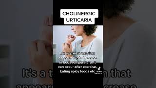 Cholinergic urticaria [upl. by Negriv891]