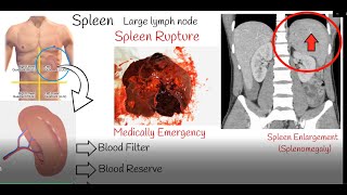 Spleen pain Spleen enlargement and Spleen rupture Causes and treatment [upl. by Aruon]