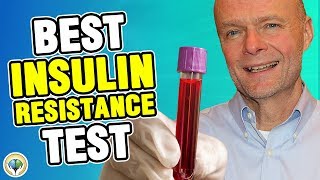 Insulin Resistance Test Best Test for IR amp Stubborn Weight Loss HomaIR [upl. by Eillo]