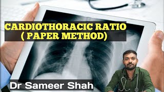 CARDIOTHORACIC RATIO CARDIOMEGALYDr Sameer Shah [upl. by Reni271]