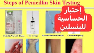 اختبار الحساسية للبنسلين Penicillin Allergic Test [upl. by Weaver]