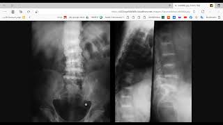 MRCP PART TWO PASSMEDICINE 2020 Gastroenterology 39 [upl. by Faro310]