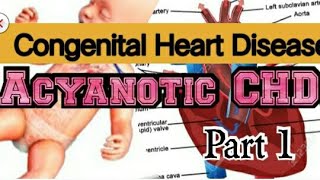 CONGENITAL HEART DISEASE ACYANOTIC CHD Simplified in HINDI PART1 [upl. by Elletsyrk459]